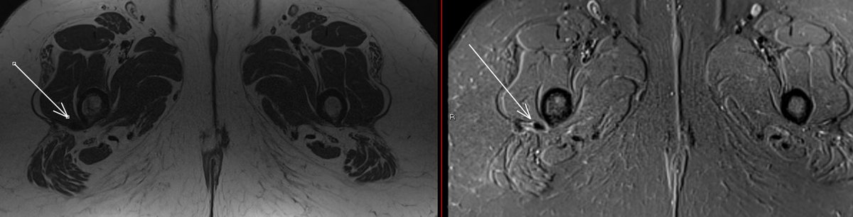 JuanMiranda tweet media