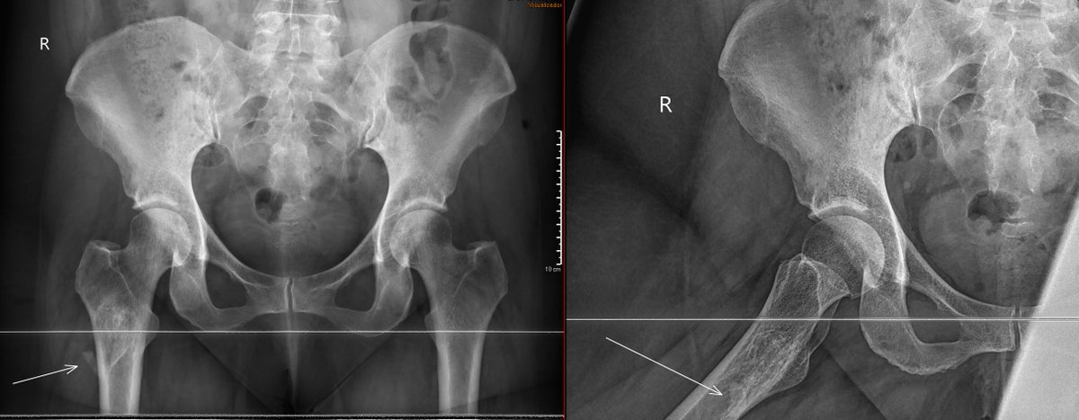 JuanMiranda tweet media