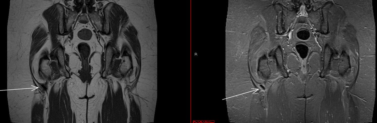 JuanMiranda tweet media