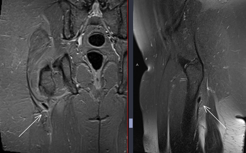 JuanMiranda tweet media