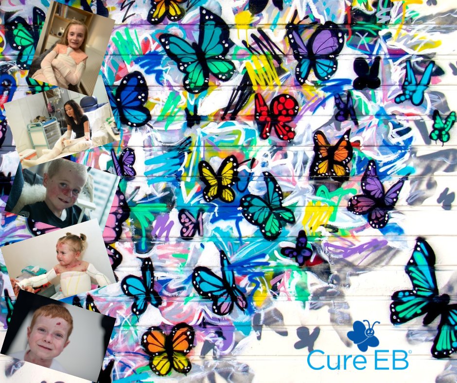 CureEBorg's tweet photo. Become a #KaleidoscopeFriend and be part of the mission to give hope to all EB children by donating to the research that seeks to end their pain. https://t.co/ZS2S0mwsfq 🦋💙
#CureEB #ResearchtheCure #SupportEBResearch #Donate #EndEB #HealEB #FightEB #Findacureforeb #Research https://t.co/62FMng688K
