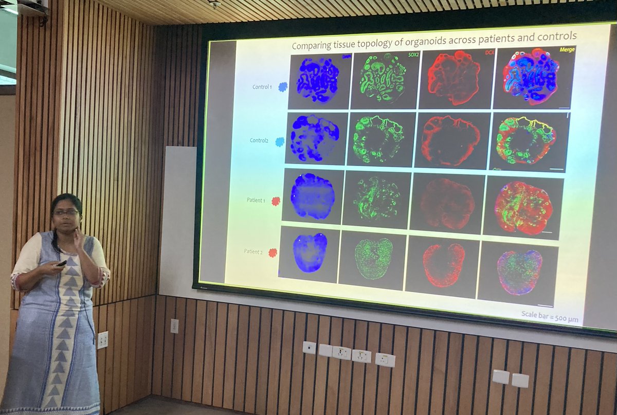 iBRIC-inStem (@dbt_instem) on Twitter photo Day 3 at the human stem cell workshop
1/2 Students and postdocs from <a href="/mbhavana10/">Bhavana Muralidharan</a> and <a href="/Dhan_inStem/">Dhandapany Perundurai</a> labs presented talks
<a href="/Kruttika_P22/">Kruttika Phalnikar</a>, <a href="/ArchishaGanguly/">Archisha</a>, <a href="/Pratuljain10/">Pratul jain</a>, <a href="/Harshilchittora/">Harshil chittora</a>,
<a href="/DBTIndia/">Department of Biotechnology</a> <a href="/BLiSC_India/">Bangalore Life Science Cluster (BLiSC)</a>
<a href="/rajesh_gokhale/">Rajesh Gokhale</a> <a href="/InamdarManeesha/">Maneesha Inamdar</a> <a href="/SangitaKasture/">Sangita M Kasture</a> <a href="/ialkasharmabjp/">Dr. Alka Sharma</a> Day 3 at the human stem cell workshop
1/2 Students and postdocs from <a href="/mbhavana10/">Bhavana Muralidharan</a> and <a href="/Dhan_inStem/">Dhandapany Perundurai</a> labs presented talks
<a href="/Kruttika_P22/">Kruttika Phalnikar</a>, <a href="/ArchishaGanguly/">Archisha</a>, <a href="/Pratuljain10/">Pratul jain</a>, <a href="/Harshilchittora/">Harshil chittora</a>,
<a href="/DBTIndia/">Department of Biotechnology</a> <a href="/BLiSC_India/">Bangalore Life Science Cluster (BLiSC)</a>
<a href="/rajesh_gokhale/">Rajesh Gokhale</a> <a href="/InamdarManeesha/">Maneesha Inamdar</a> <a href="/SangitaKasture/">Sangita M Kasture</a> <a href="/ialkasharmabjp/">Dr. Alka Sharma</a>