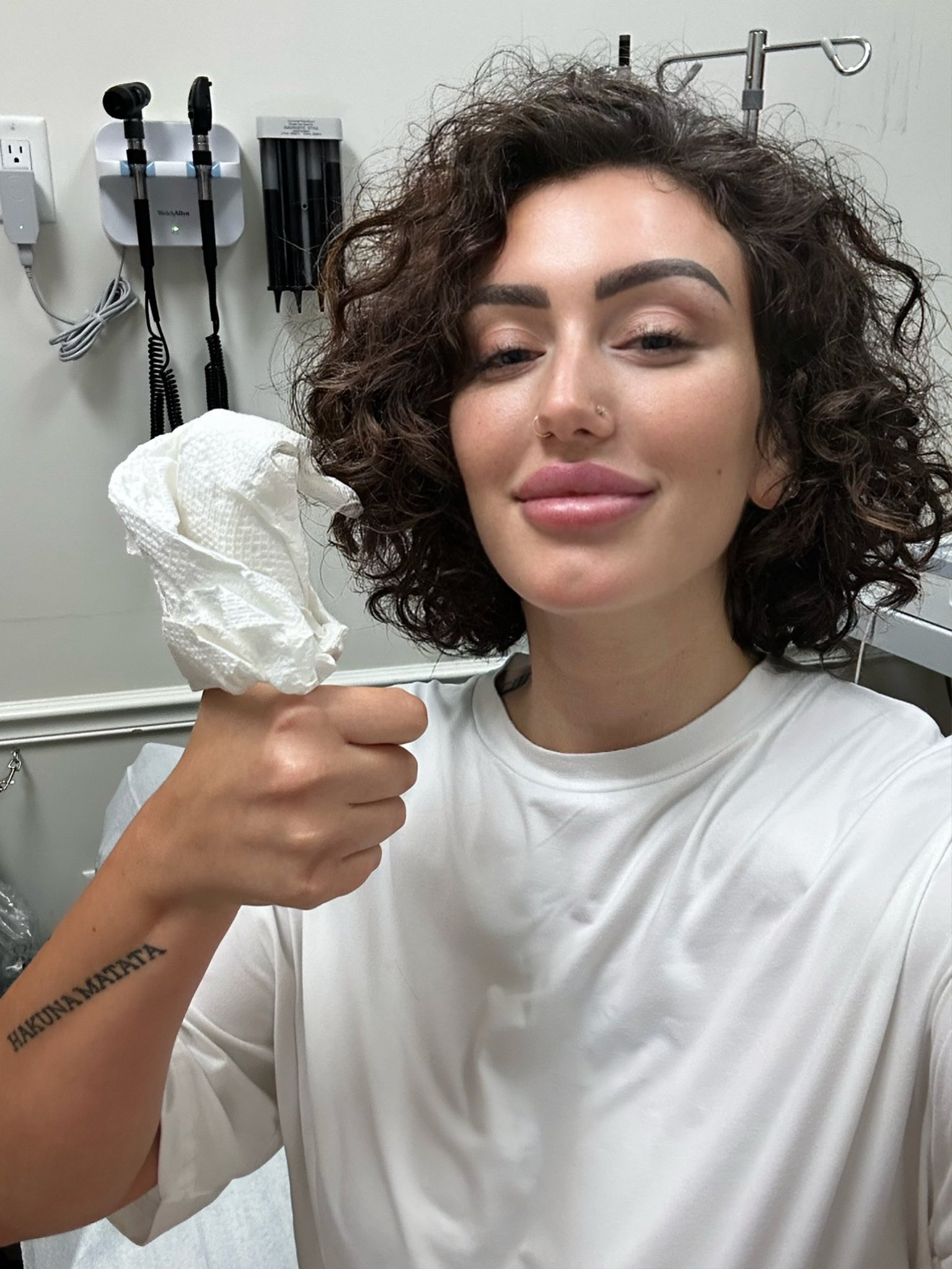 Franncchii on X: Thumbs up for stitches t.cou2B0FPrnT7  X