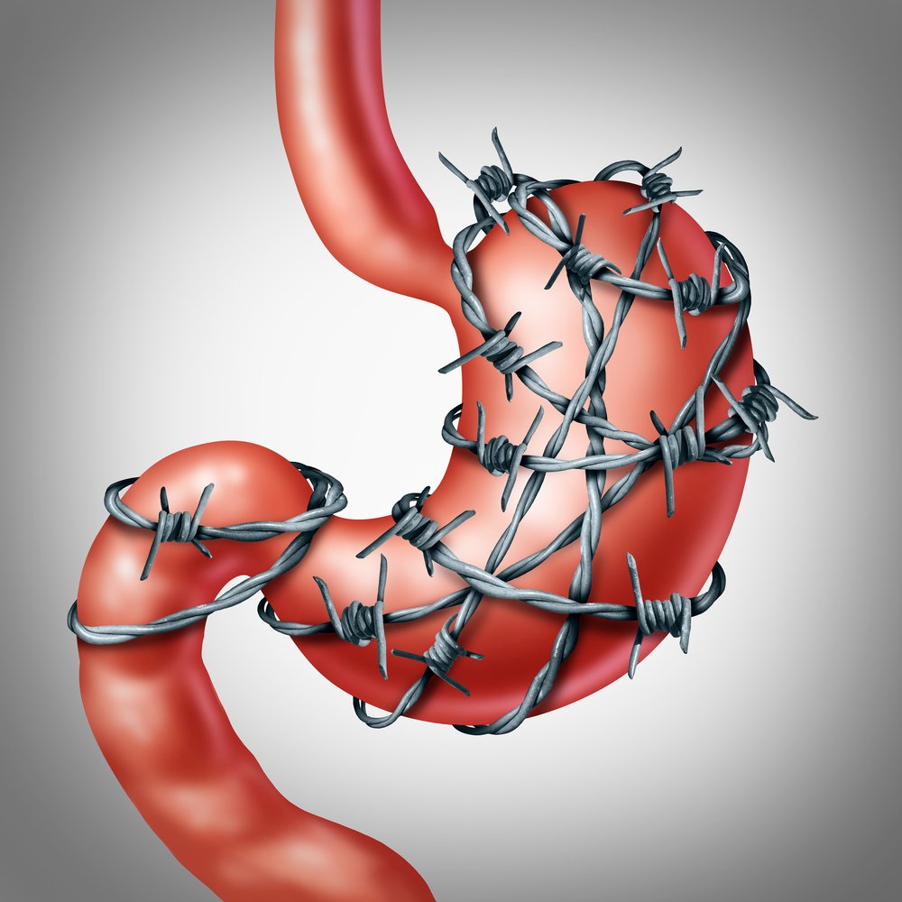 #GastroparesisAwarenessMonth comes to an end today. There is no denying that #Gastroparesis remains one of the most challenging diagnoses in GI practice. We got to recap a lot of great lessons and reminders, this month. #MedTwitter and #GItwitter, here's a thread 🧵: