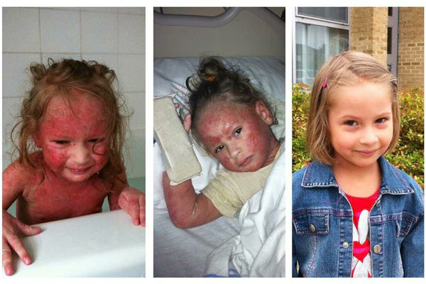 Is it the god-complex of doctors that makes it so hard for them to accept that topical steroids can cause horrific harm and are far from safe?

Do they believe they can't be wrong?