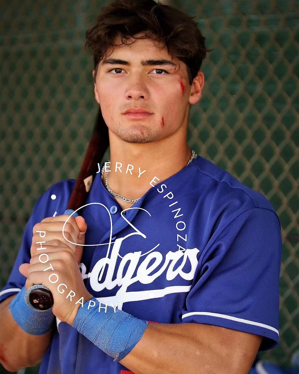 Its not often I get good bloody photos in baseball. Los Angeles Dodgers 2023 8th round draft pick Jaron Elkins provided the opporrunity today after crashing into the outfield wall at the Kansas City Royals complex.