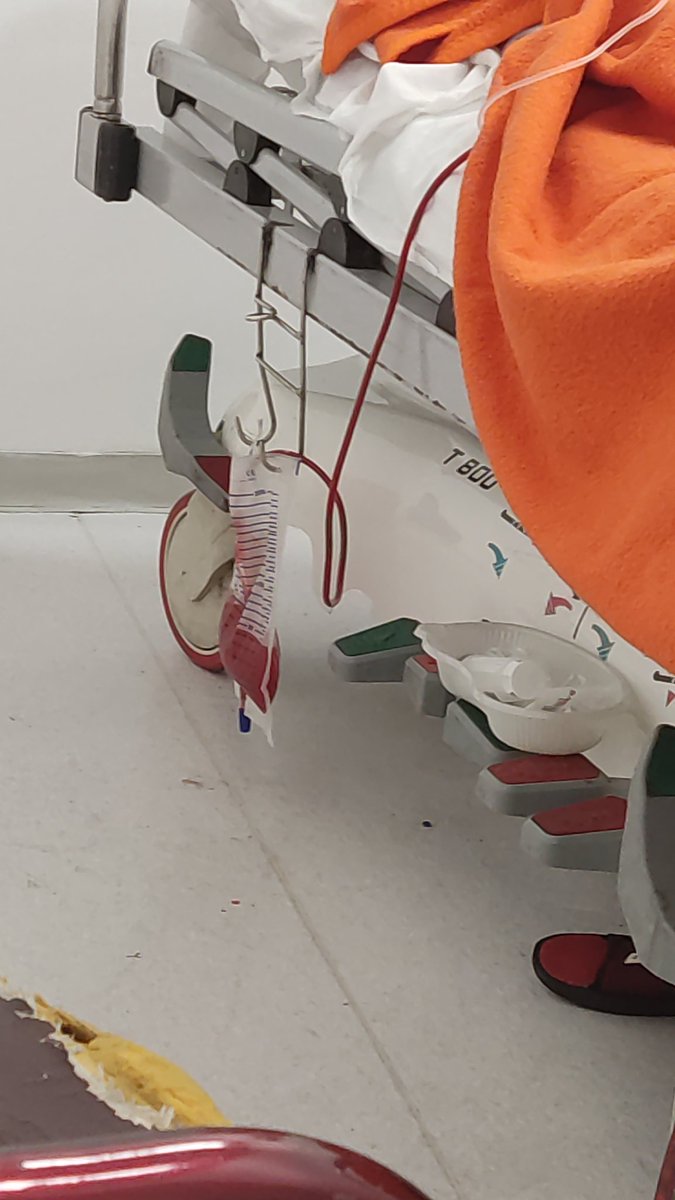 murat dilmener de 4 gündür şu sekilde kanyan hastaya teşhis koymayıp acilde bekletiyorlar inanılmaz gerçekden sakın yolunuz buraya düşmesin sakın <a href="/drfahrettinkoca/">Dr. Fahrettin Koca</a>  <a href="/saglikbakanligi/">T.C. Sağlık Bakanlığı</a> <a href="/sagliklicozum/">T.C. Sağlık Bakanlığı Sağlıklı Çözüm</a>