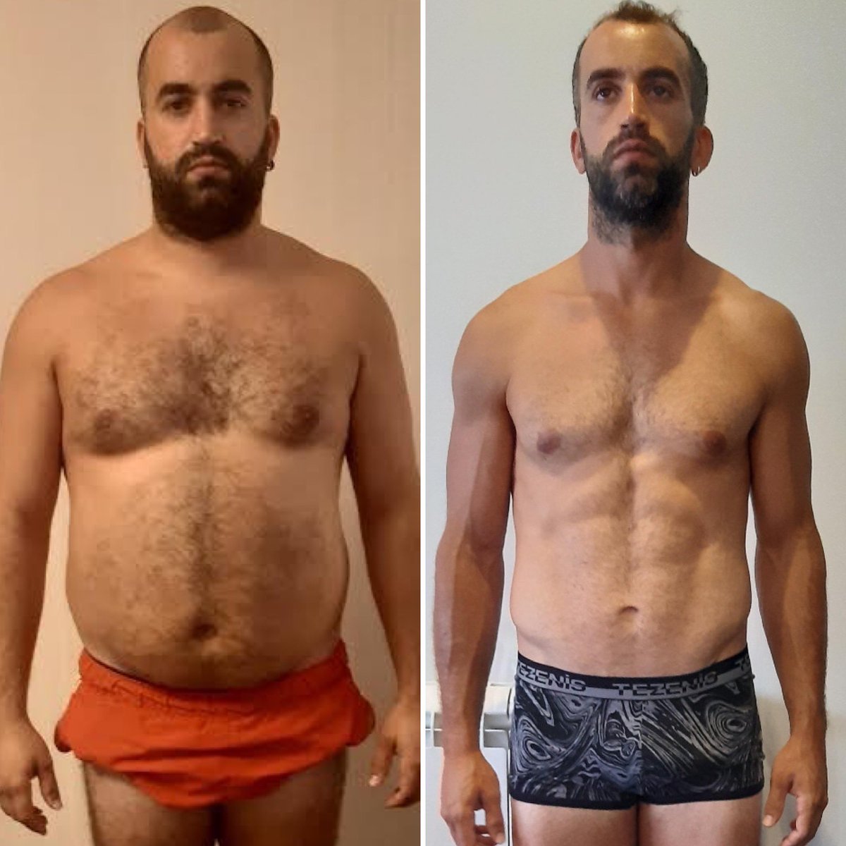 O André iniciou a sua jornada connosco com 94kg e 108 cm de cintura e após 60 semanas chegou aos 69,1kg e aos 83 cm de cintura.
-
Assim, só podemos agradecer, mais uma vez, ao André o seu compromisso e disciplina ❤️
-
Muitos parabéns pelos resultados obtidos 🙂