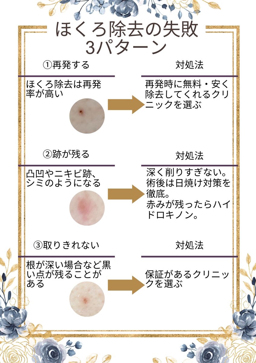 ほくろ 除去 失敗