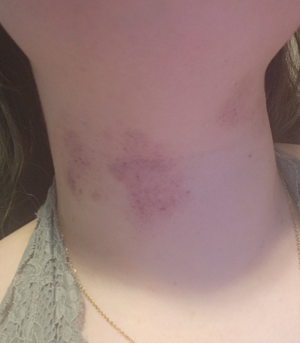 Xjustjojox's tweet photo. Who's tryna leave marks? https://t.co/ohEdL9rp3A