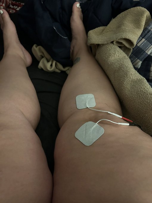 Current status! 😓 I really hate falling on my knees. Even with therapy the pain bothers me a lot. 😭😩<a href="/tag/mvsales"class="tags"><span>#mvsales</span></a>