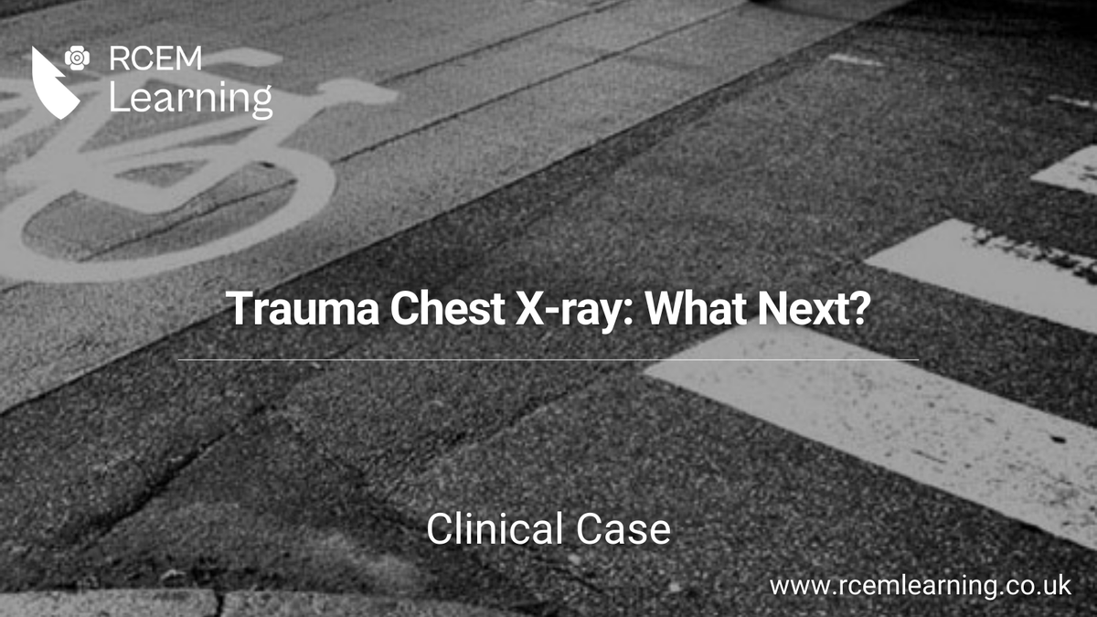 UPDATE: A 43-year-old cyclist arrives after being struck by a car. He comes with spinal immobilisation on a scoop stretcher with evidence of bruising to the right chest, abdomen, and pelvis. Read our #ClinicalCase here🆓: rcemlearning.co.uk/modules/trauma…
