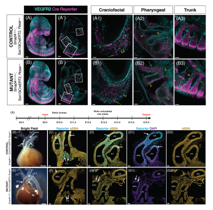 HaoYin20's tweet photo. A beautiful study on aorta development & #NeuralCrestCell/#SmoothMuscleCell differentiation/migration/survival
SMC of different origins compensate each other almost completely in aortic morphogenesis😎
Are these🐭more susceptible to aortic stress #ThoracicAorticAneurysm? https://t.co/RBTp5RjYLD