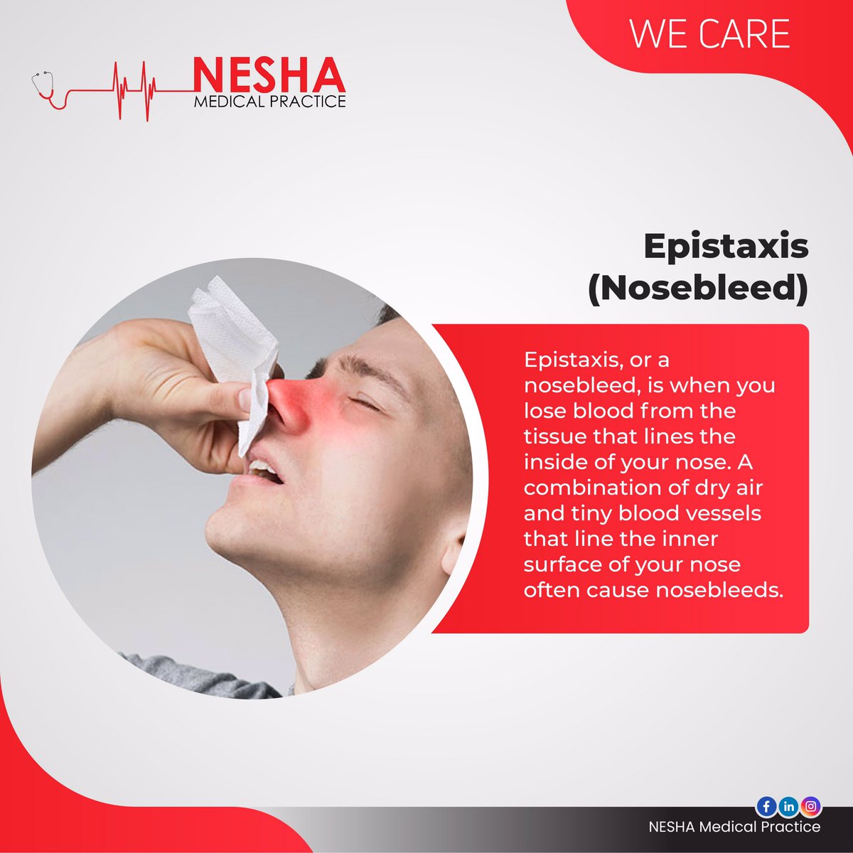 NeshaMedical's tweet photo. DID YOU KNOW?
 
Epistaxis is common. About 60% of people will have at least one nosebleed in their lifetime. Only about 10% of cases are severe enough to require medical treatment.

#epistaxisawareness https://t.co/asZSiNieRp
