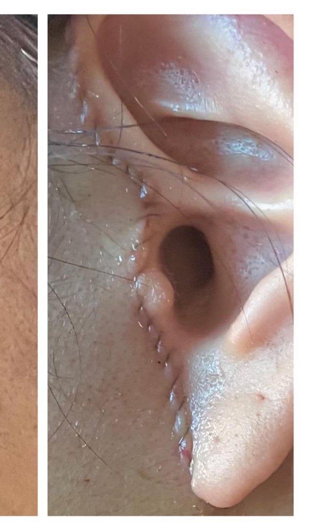 スタート整形外科&ヨンセUP整形病院の案内 tweet media