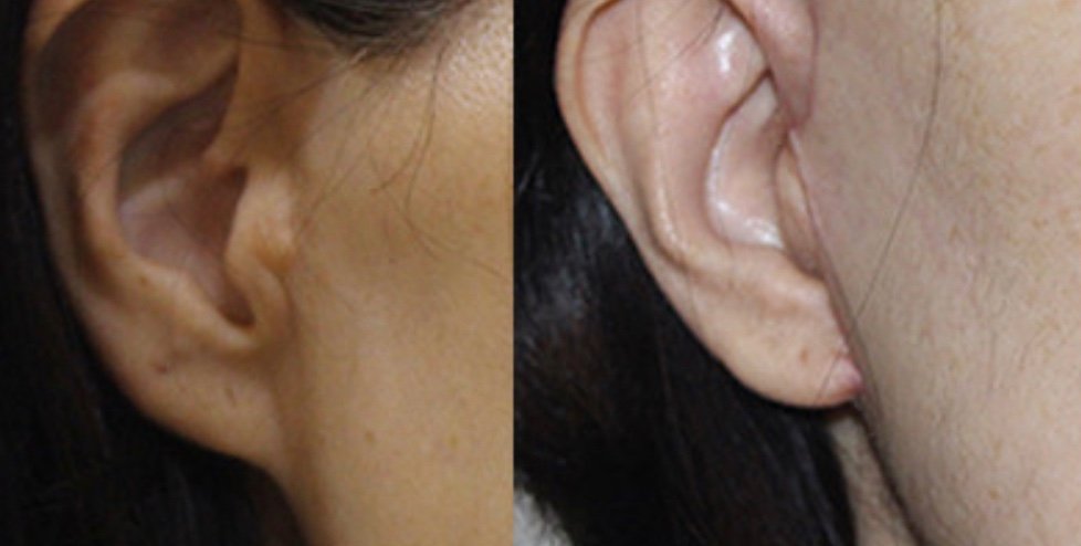 スタート整形外科&ヨンセUP整形病院の案内 tweet media