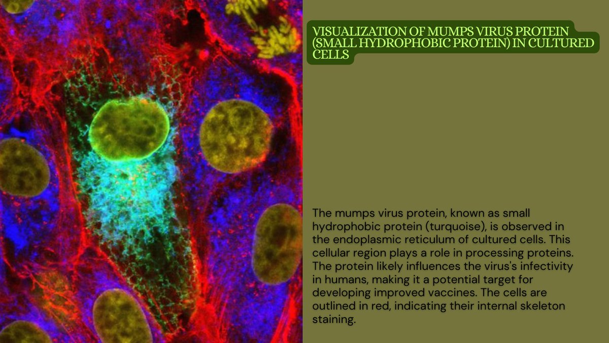 ReseaproCBDS's tweet photo. Fascinating #discovery! #Scientists visualize #mumpsvirus protein, 'Small Hydrophobic Protein' (turquoise), in #endoplasmicreticulum. It affects #virus infectivity in humans! Understanding it could lead to better #mumps #vaccines. Exciting times for vaccine #research! https://t.co/ZMBeaVL6pw