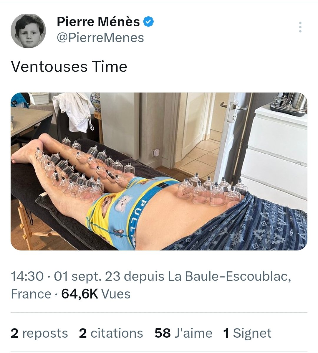 Corsicaiacciu's tweet image. Les pieds de #PierreMenes c'est comme la queue des lézards, ça repousse après une amputation.
