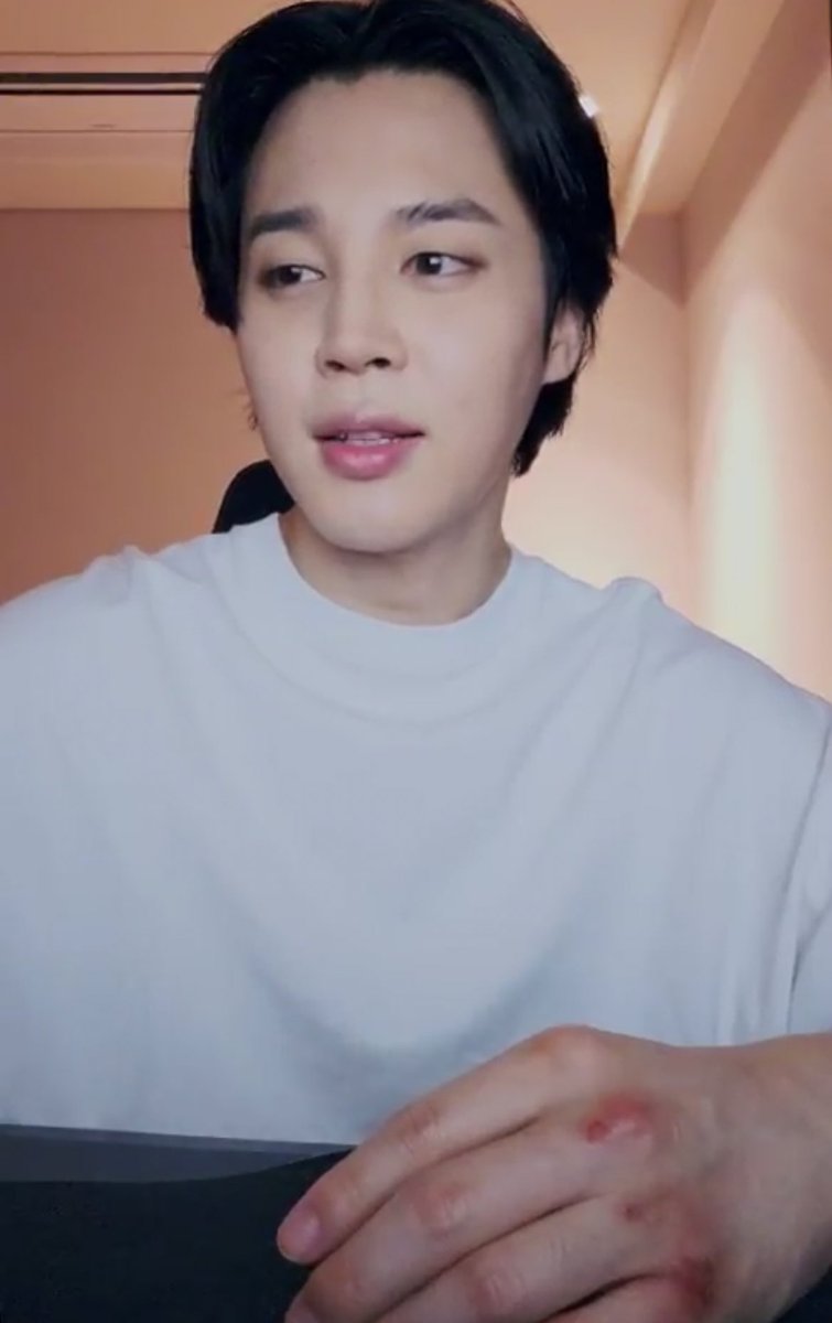 spritejimi's tweet photo. jimin’s knuckles :( BUBBLEWRAP HIM ASAP https://t.co/evE0FMRYmy