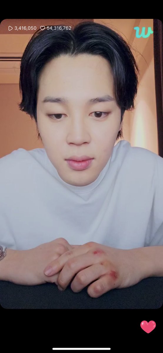 slaymadipity's tweet photo. Wait what happed to jimins hand?? https://t.co/uuGJdNLVXh
