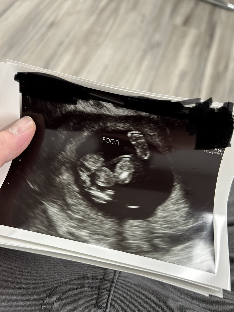 Having a baby girl in February 🥹🥰