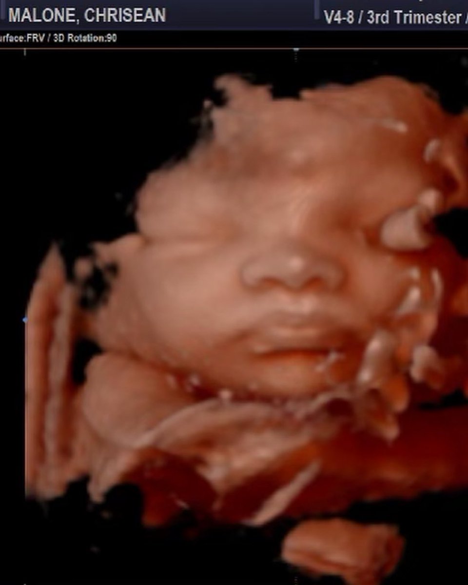 blacbarbie_000's tweet image. I am so loving this for her❤❤❤
#chrisean #teamrock