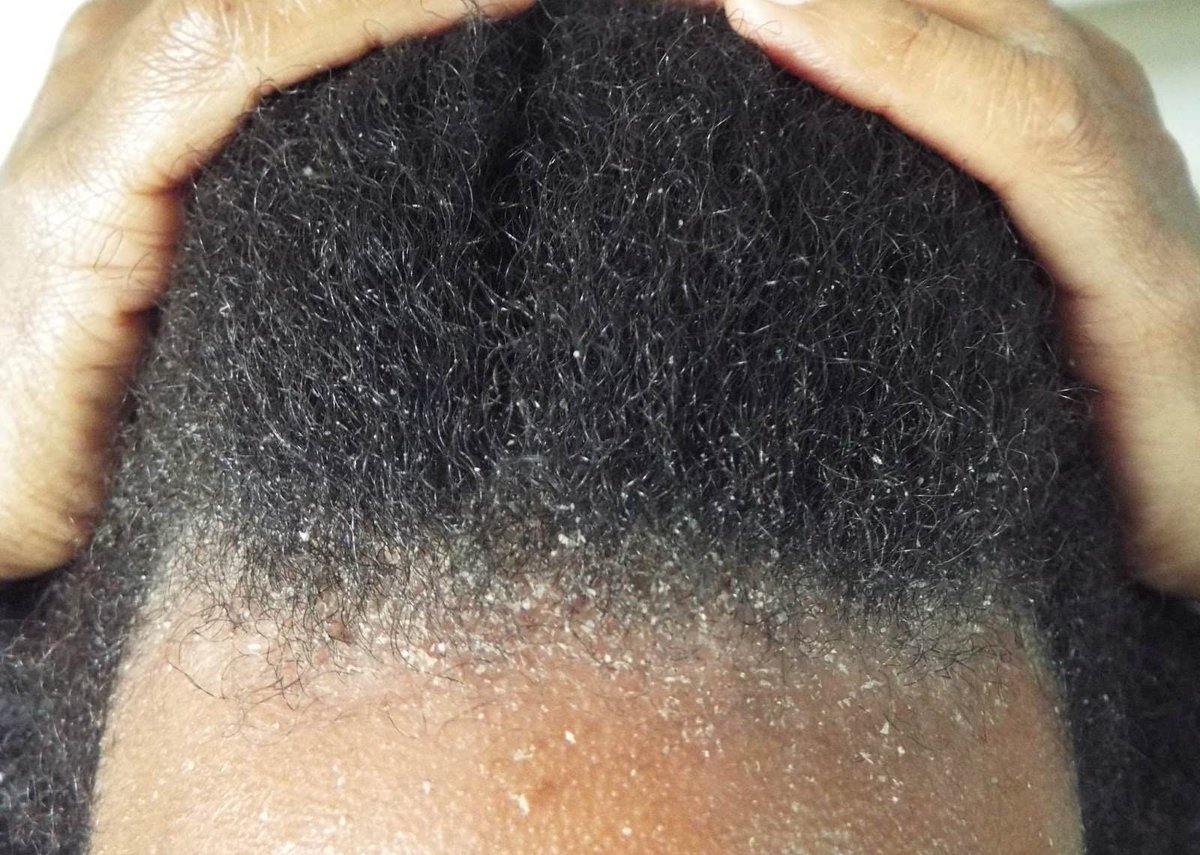 NaijaFarmer tweet media