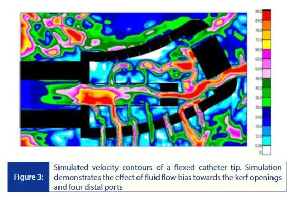 JAFIB&EP (@jafib_ep) on Twitter photo A Comparison of The TactiCath™ Ablation Catheter, Sensor Enabled™ and The FlexAbility™ Ablation Catheter, Sensor Enabled™ For Myocardial Ablation buff.ly/43Lge3V @abbottcardio <a href="/JRWinterfield/">Jeffrey Winterfield</a> A Comparison of The TactiCath™ Ablation Catheter, Sensor Enabled™ and The FlexAbility™ Ablation Catheter, Sensor Enabled™ For Myocardial Ablation buff.ly/43Lge3V @abbottcardio <a href="/JRWinterfield/">Jeffrey Winterfield</a>