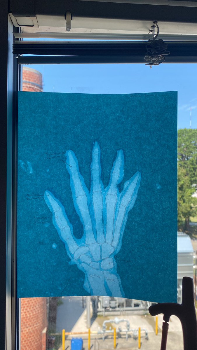 gooseRRT's tweet photo. Learning about radiology in Diagnostic Medicine!
@CTE4KCS @FultonHigh @AcademyofHHS https://t.co/DzZ6NrT7Gy