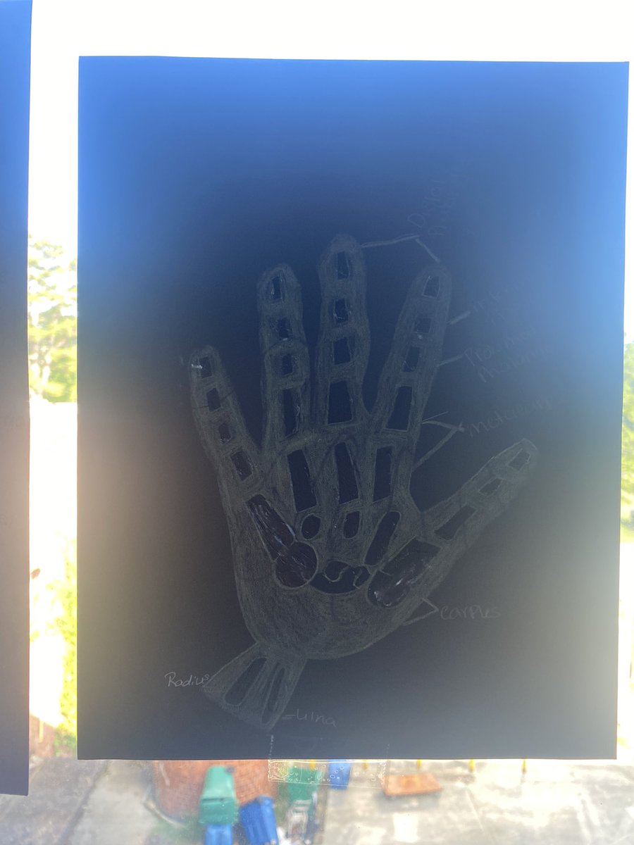 gooseRRT's tweet photo. Learning about radiology in Diagnostic Medicine!
@CTE4KCS @FultonHigh @AcademyofHHS https://t.co/DzZ6NrT7Gy