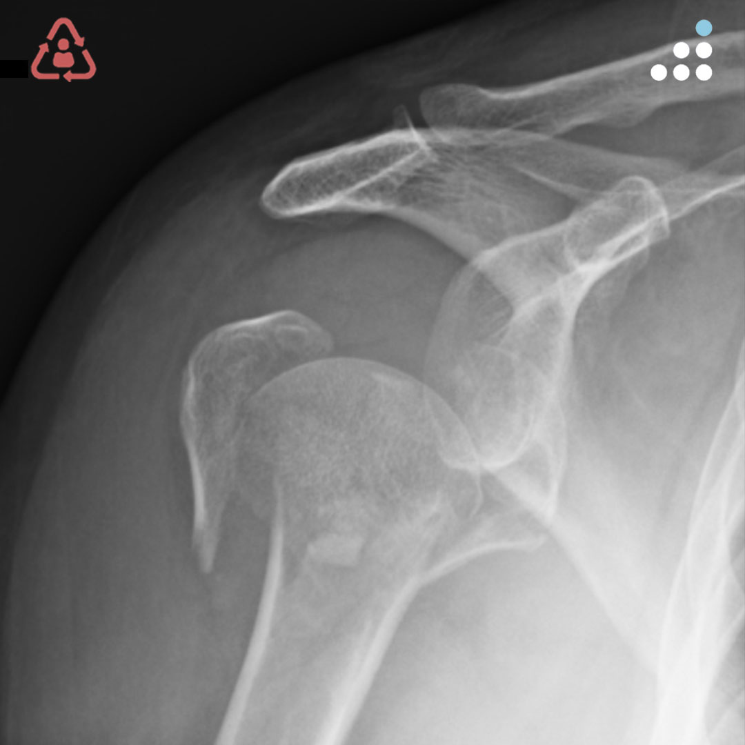 Orthobullets tweet media