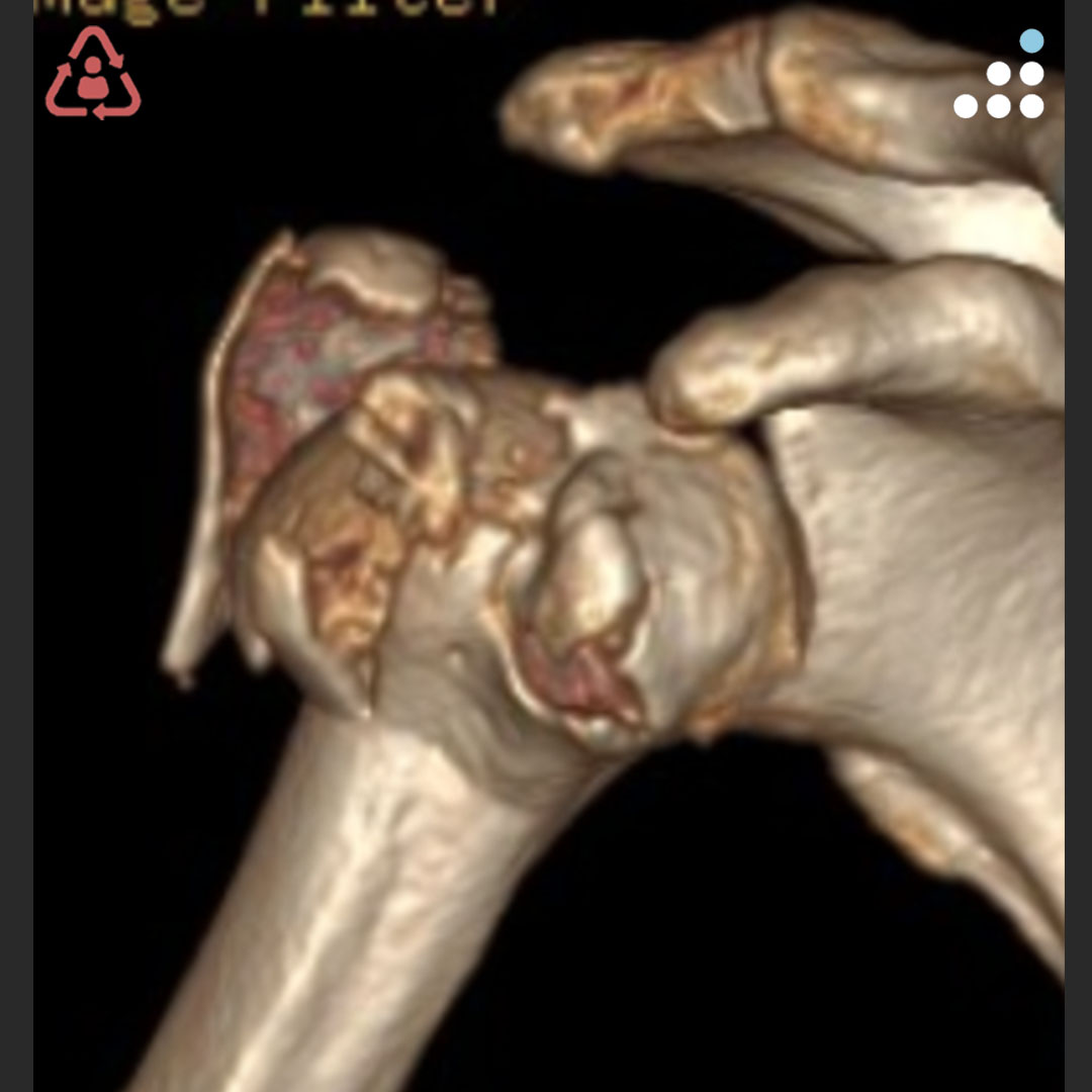 Orthobullets tweet media