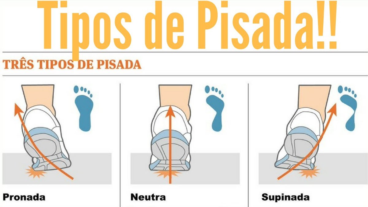 mobi_hacks's tweet image. 2️⃣ Tipos de Pisada 🦶:
Existem três tipos principais de pisada:
#Pronada: O pé rola para dentro.
#Neutra: O pé rola uniformemente.
#Supinada: O pé rola para fora.
Cada tipo requer um tipo específico de suporte no tênis. Identificar o seu é o primeiro passo. 🧐👟