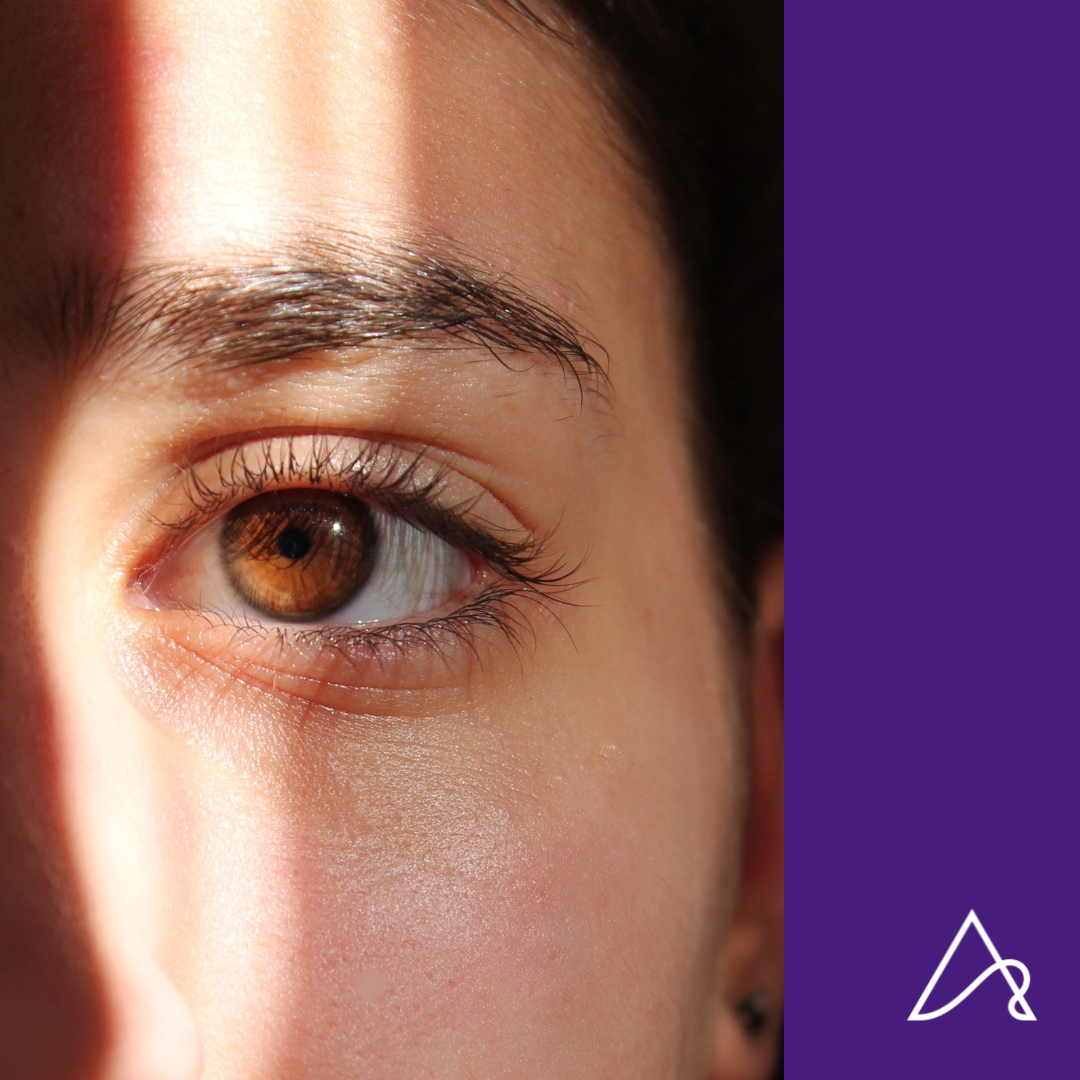 Blepharoplasty, commonly known as eyelid surgery, is a transformative procedure aimed at lifting and tightening sagging skin around the eyelids. 

#eyelidsurgery #blepharoplasty #plasticsurgery #aestheticsurgery #aestheticprocedure