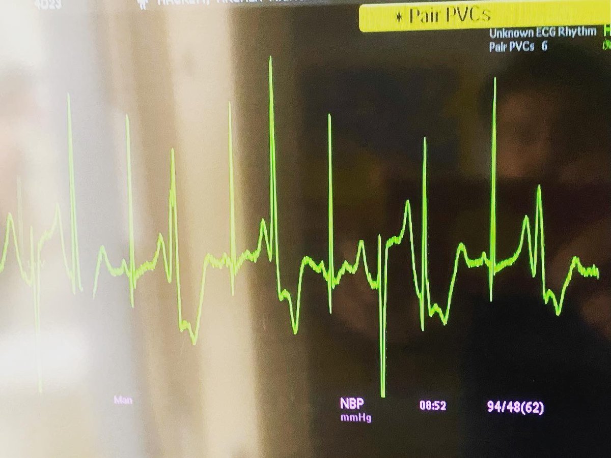 Sean Hackett tweet media