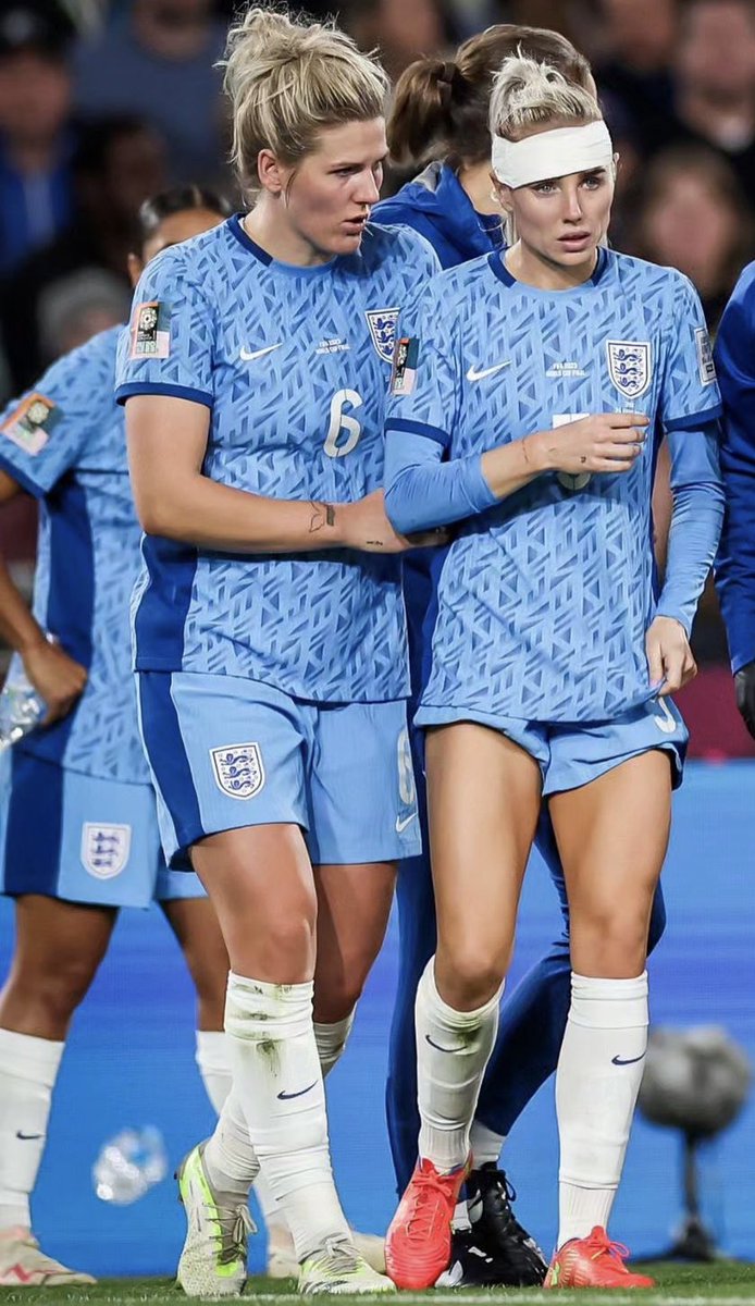 Alex Greenwood changed her bloody kit on the pitch during the World Cup Final, and had her bleeding wound dressed having being kicked in the head, before getting to her feet and playing out the rest of the game. 

No rolling around, no faking injury. This is women’s football.