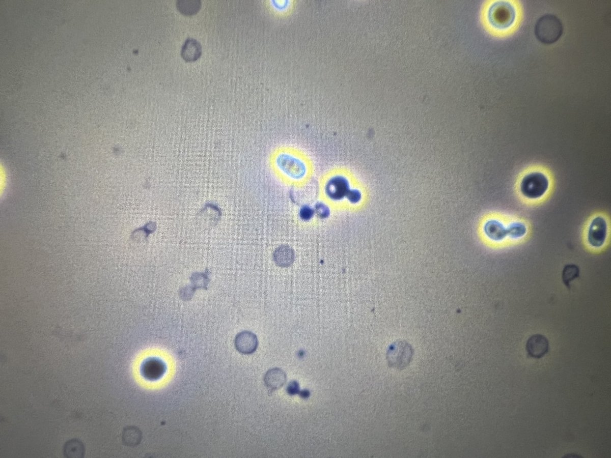 msc271's tweet photo. #Acanthocytes https://t.co/srsUmRXHZT