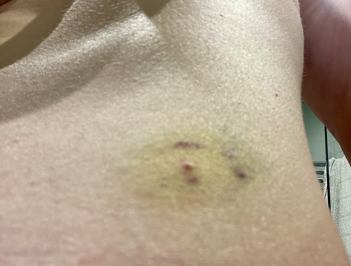 Kate Lambley tweet media