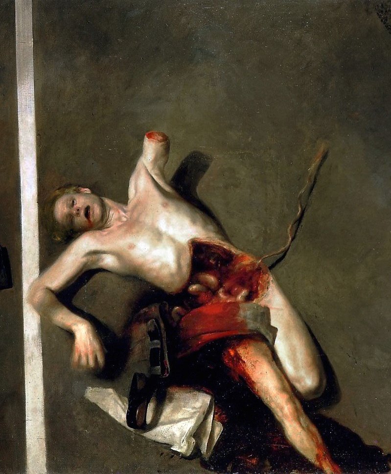 solisolsoli's tweet photo. Amputation, 1968, by Odd Nerdrum https://t.co/DzfzY23DWV