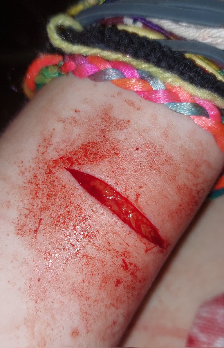 p4ssword101's tweet photo. One of my favorite cuts on my wrist :3 https://t.co/fsnwFSf6d3