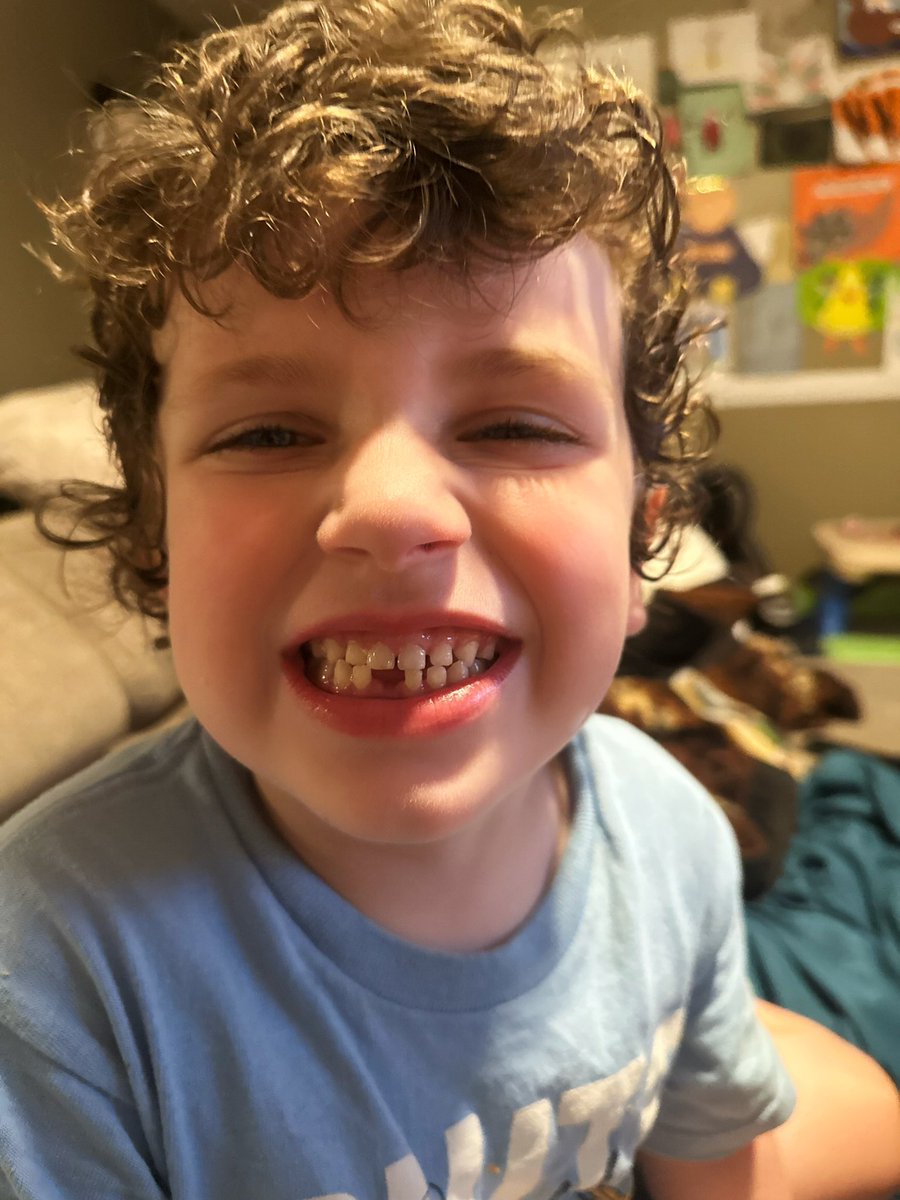 cherishlombard's tweet photo. Can’t believe my baby boy just lost his first tooth!🦷
He actually lost it! We looked everywhere 😢
#tooth #firsttooth #growingup #milestone #toothfairy #toothless #losttooth #foryou #momlife #mixedemotions #5yearsold #sad #mybaby #missingtooth #momlifebelike #babytooth #teeth https://t.co/p90TMsKPqz