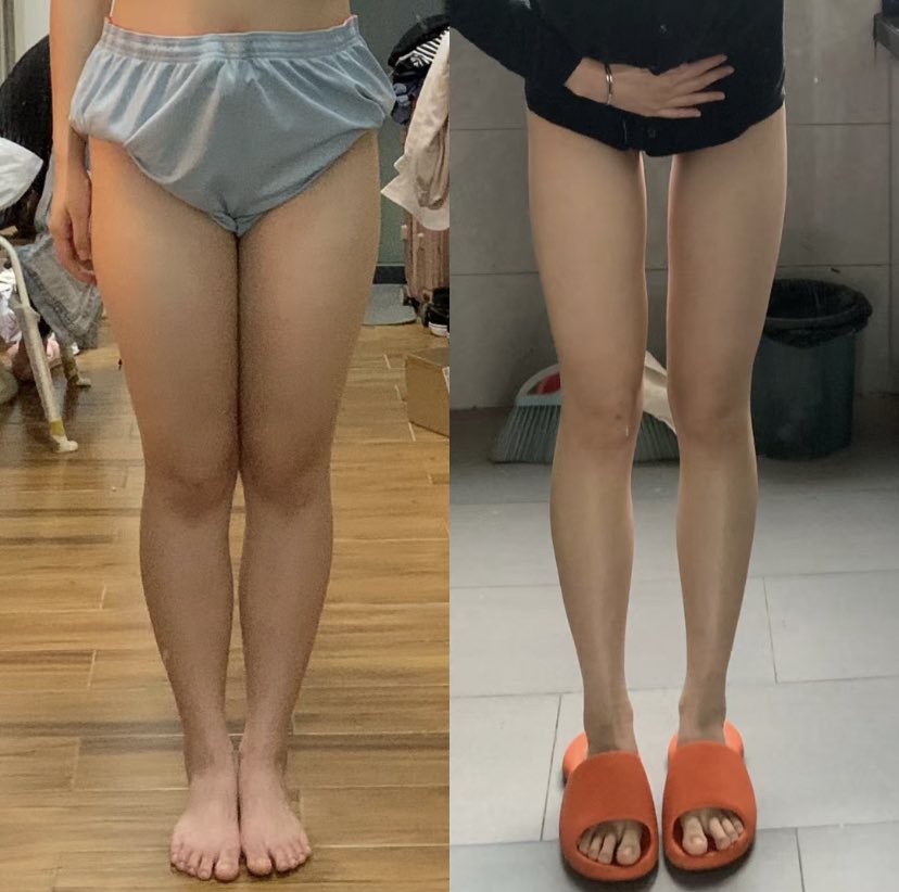 _edtw_thinsp0's tweet photo. • Before and after https://t.co/fL8riDxwpe