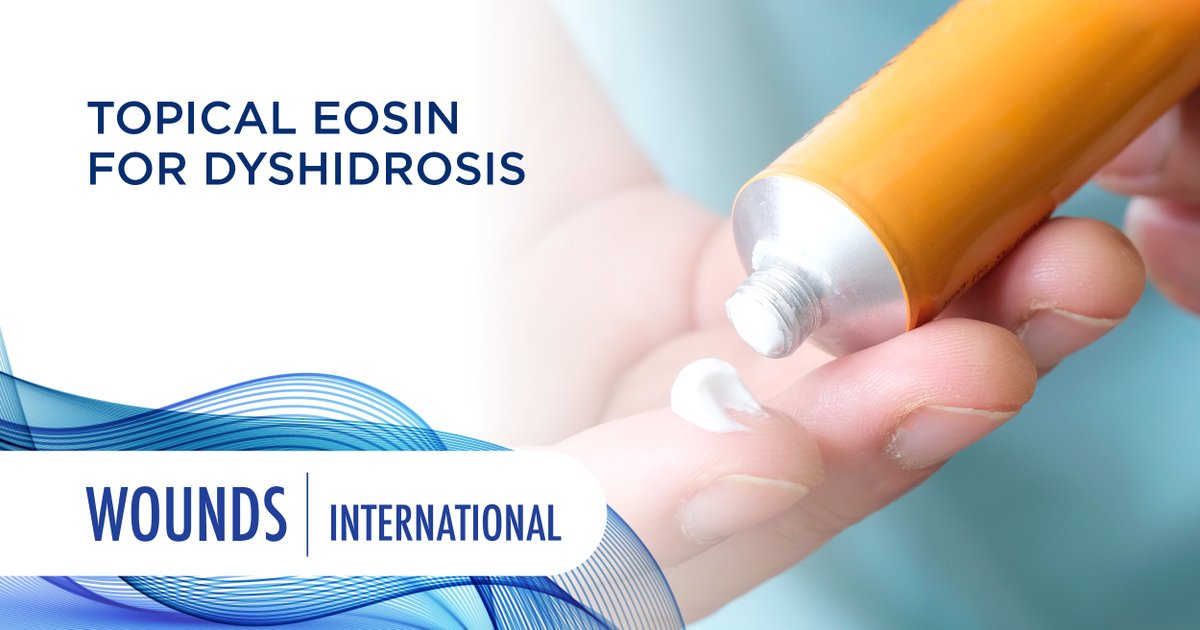 WoundsIntnl's tweet image. This case report describes a successful result of hand dyshidrosis in a young man treated with topical eosin 2% only, as an alternative option to topical steroids where a complete skin recovery was achieved after a 2-week treatment window: ow.ly/2jYQ50PAHzg #WINT #Wounds