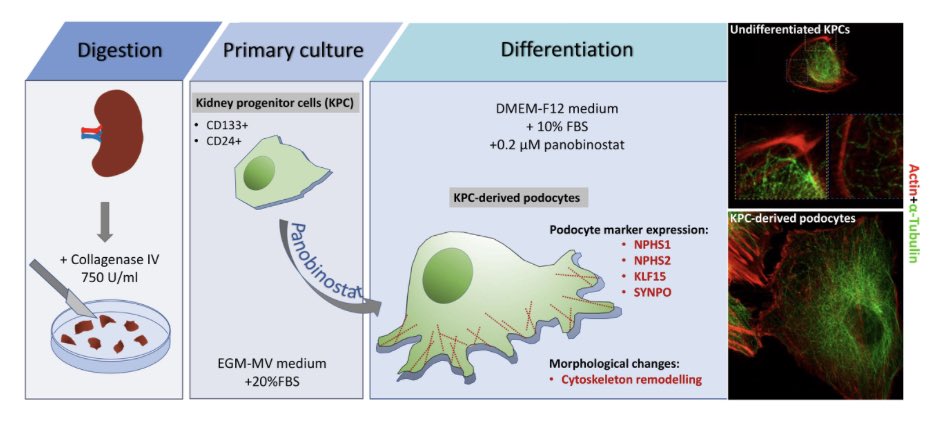 We just published detailed protocols for preparation of human kidney progenitor cultures and their differentiation into podocytes, a very useful tool for study their biology bio-protocol.org/e4757