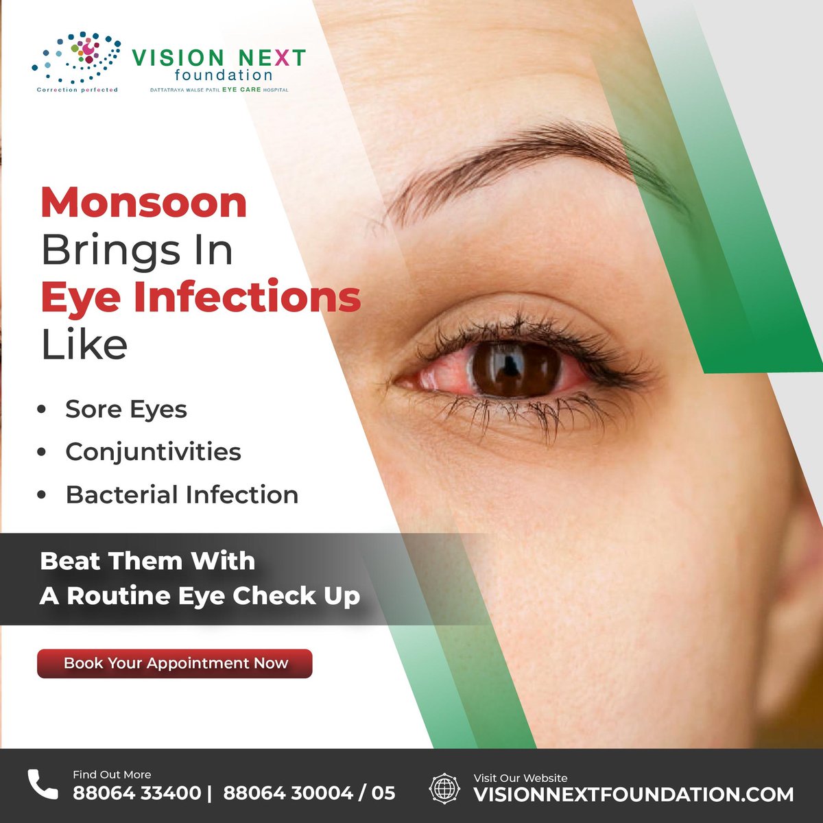 The white part of the eye and the surface of the eyelids are covered with a thin membrane called conjunctiva.
For more details to visit  visionnextfoundation.com OR Call on 88064 30004
#visionnext #lasik #eyesurgery #lasikcenter #visioncorrection  #eyehospital #opthalmologist