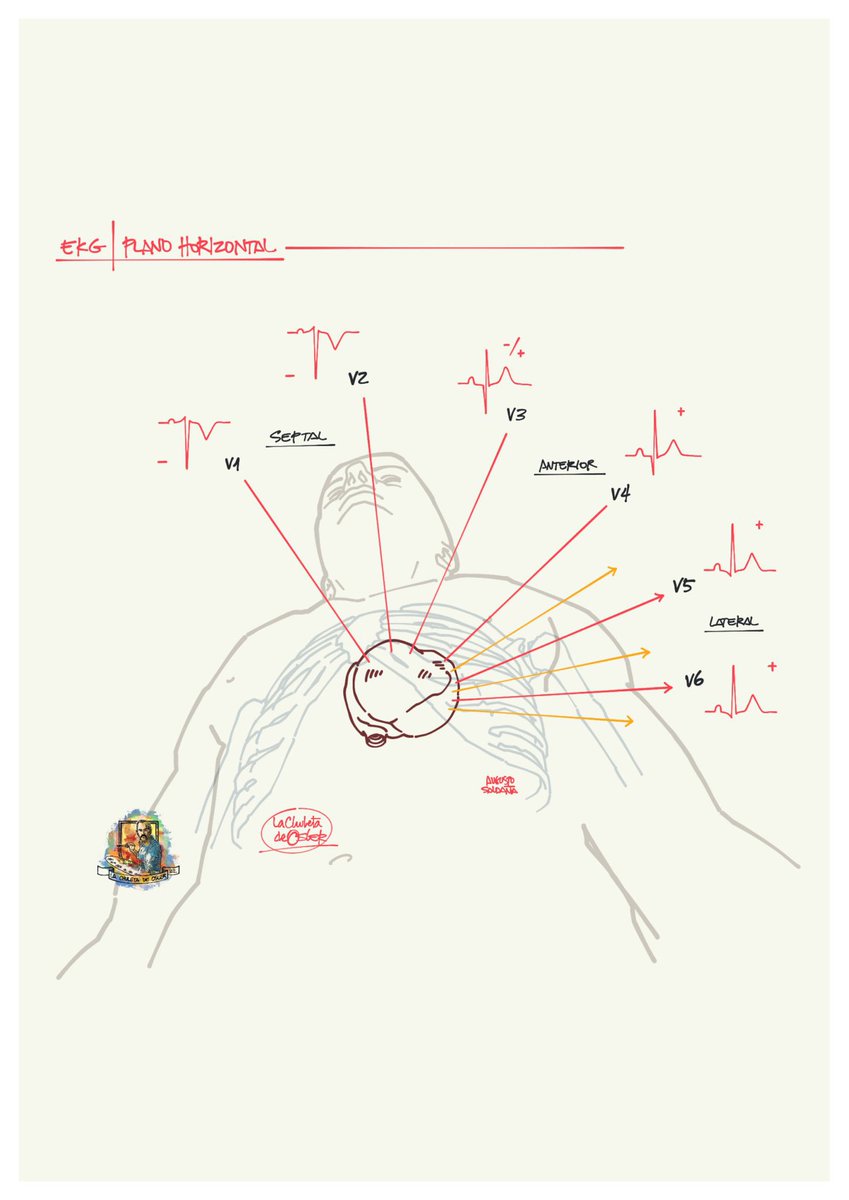 chuletadeosler's tweet photo. ECG: derivaciones y caras vistas desde plano frontal y horizontal: https://t.co/2wMzDcQpuf