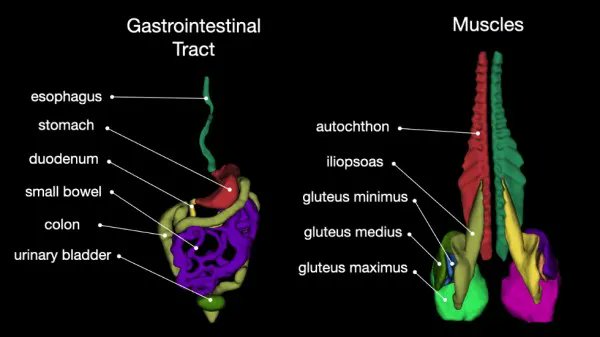 A publicly available CT #segmentation model segments most anatomically relevant structures in the whole body doi.org/10.1148/ryai.2… <a href="/JakobWasserthal/">Jakob Wasserthal</a> <a href="/MSegeroth/">Martin Segeroth</a> #TotalSegmentator #MachineLearning #AI