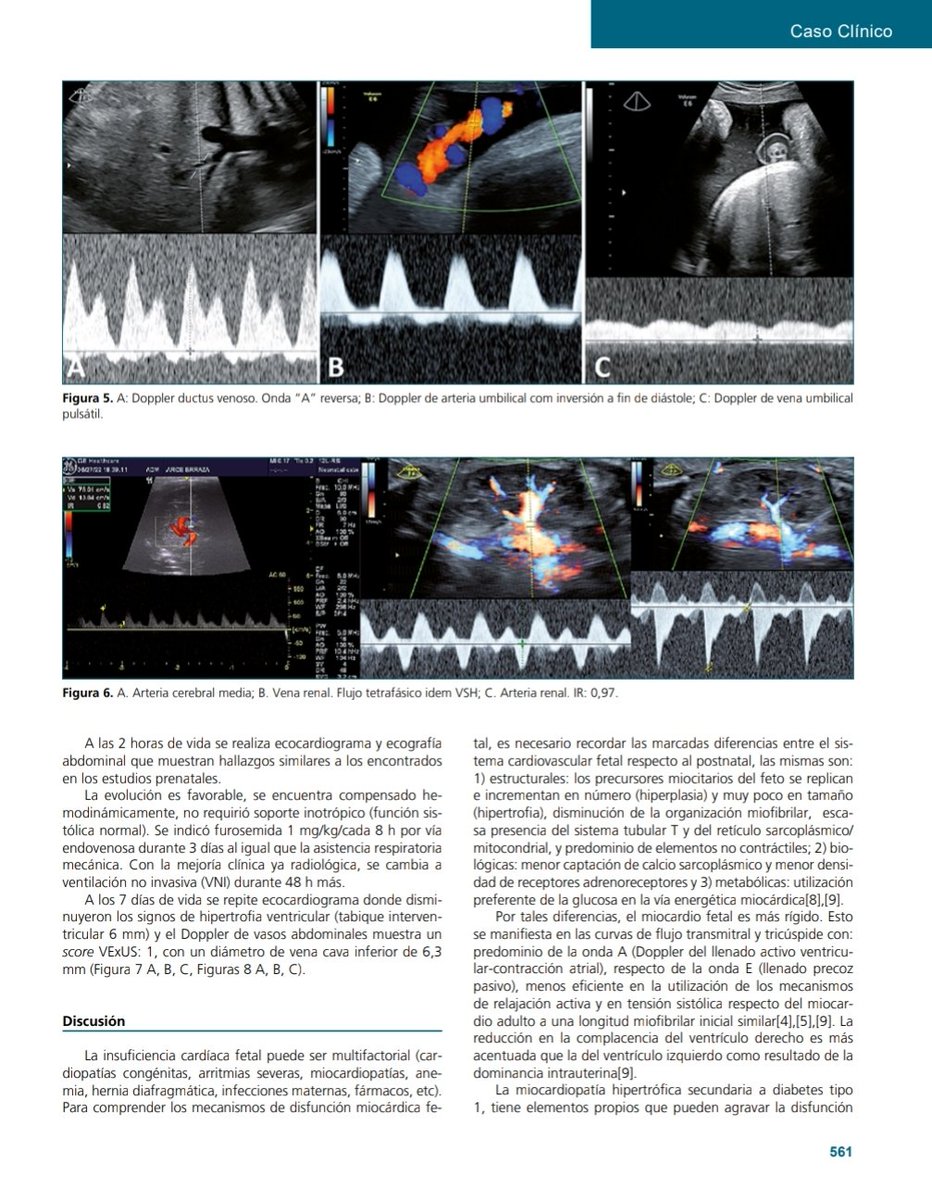 Presentamos con gran satisfacción nuestra última publicación en la prestigiosa Revista Chilena de Anestesia  ,una aproximación a la valoración de la congestión venosa en el período fetal y su excelente utilidad. Un orgullo publicarla con excelentes colegas y amigos.Un