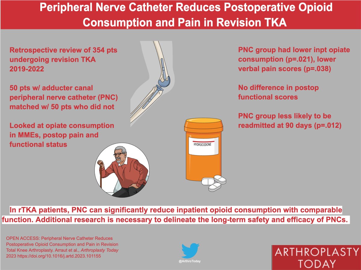 This study from <a href="/NYUARResearch/">NYU Langone Adult Reconstruction Research Center</a>  found rTKA pts w/peripheral nerve catheter had lower inpt opiate consumption &amp; pain scores compared w/no catheter, &amp; no diff in postop functional scores. #orthotwitter <a href="/MdSchwarzkopf/">Ran Schwarzkopf MD</a>  <a href="/UcheUmehMD/">Uchenna Umeh, MD, FASA, FASRA</a>  <a href="/JThomasMed/">Jeremiah Thomas</a> <a href="/ArrautJerry/">Jerry Arraut</a> 

arthroplastytoday.org/article/S2352-…