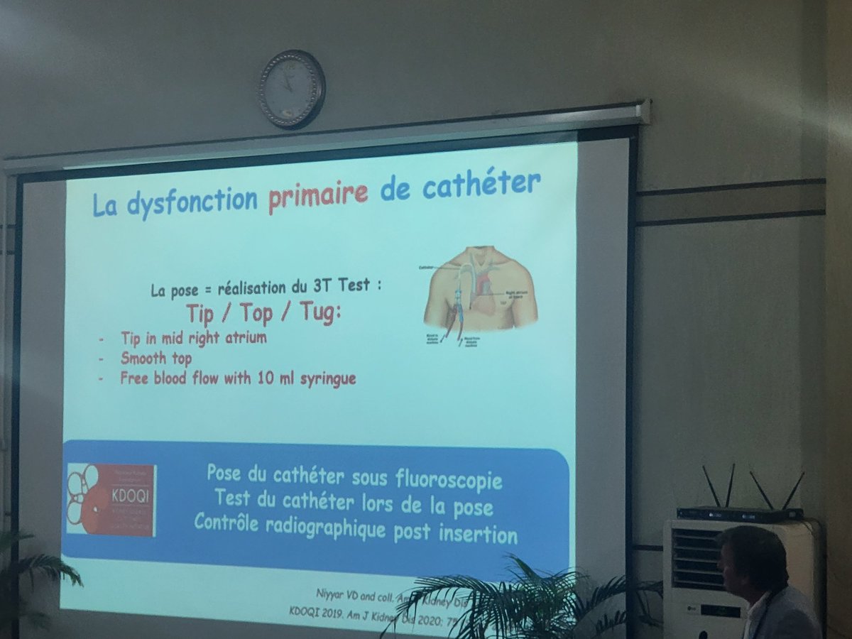 La dysfonction du catether en hemodialyse, un phénomène fréquent. Dès la pose su catether faire le test au 3T @CN23SOCONEPH @AfricanAFRAN @SabineKaram6 @com_SFNDT @lobbedez_t